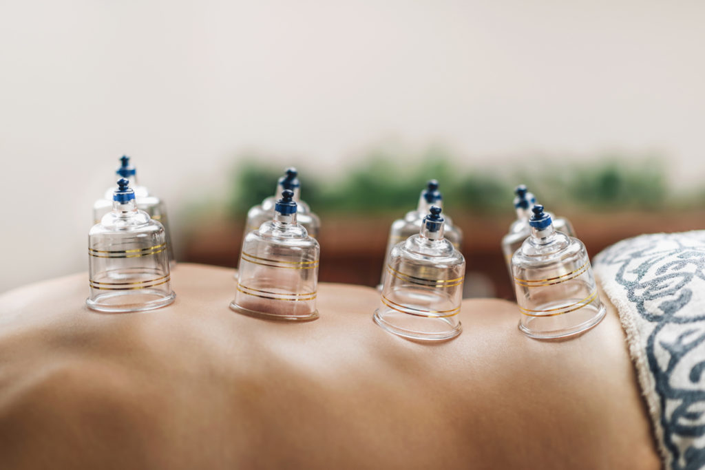 cupping-treatment-by-wellnestpro